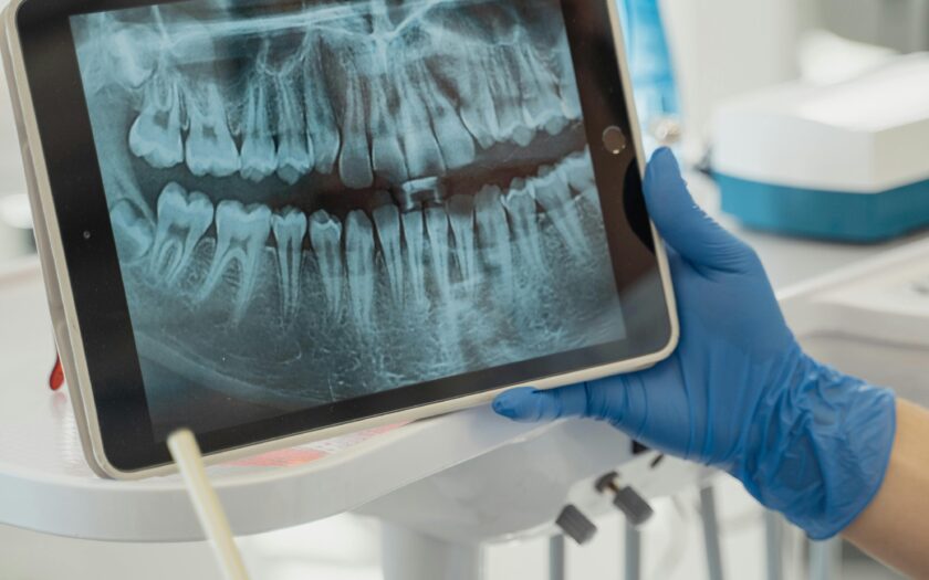 A Patient Dental X-ray on a Tablet Screen